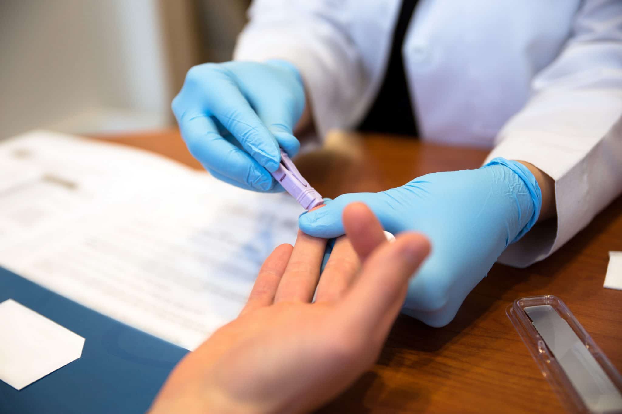 hiv testing